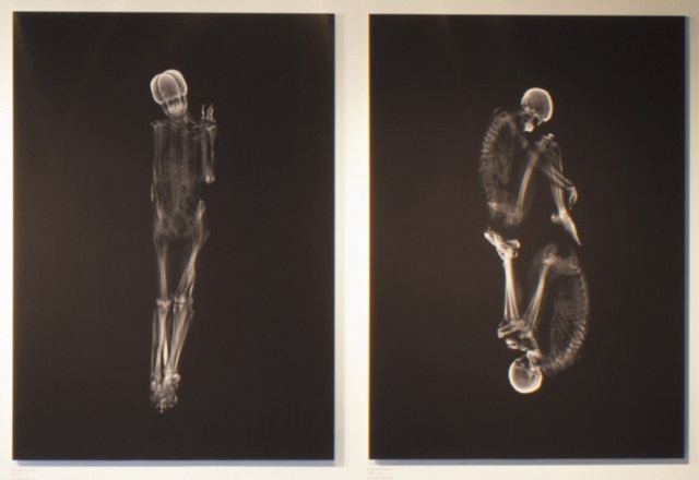 Intimate X-Ray Portraits of Couples by Ayako Kanda and Mayuk Hayashi